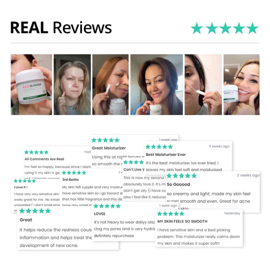 Dr.G Red Blemish Clear Soothing Cream 닥터지 레드 블레미쉬 클리어 수딩 크림 70ml - Image 8