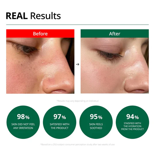 Dr.G Red Blemish Clear Soothing Cream 닥터지 레드 블레미쉬 클리어 수딩 크림 70ml - Image 3