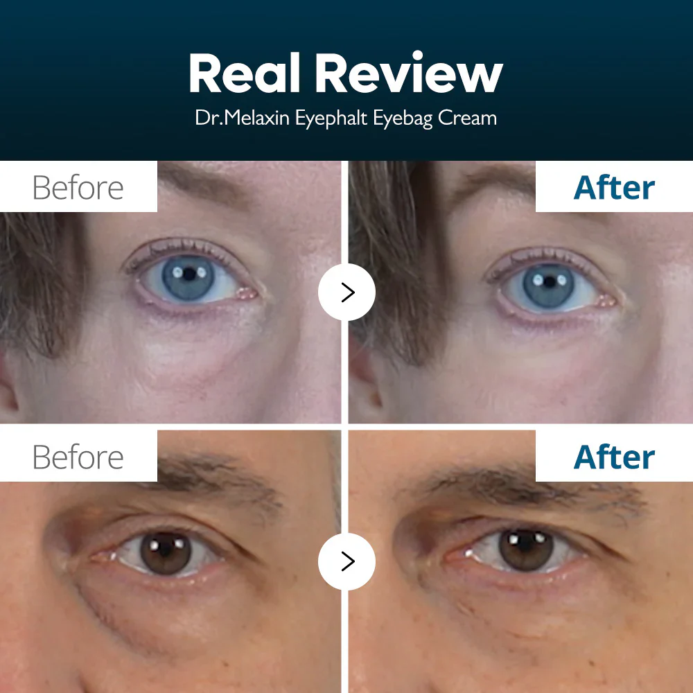 Dr. Melaxin Eyephalt Eyebag Cream 10ml 닥터 멜락신 아이팔트 아이백 크림 10ml - Image 5