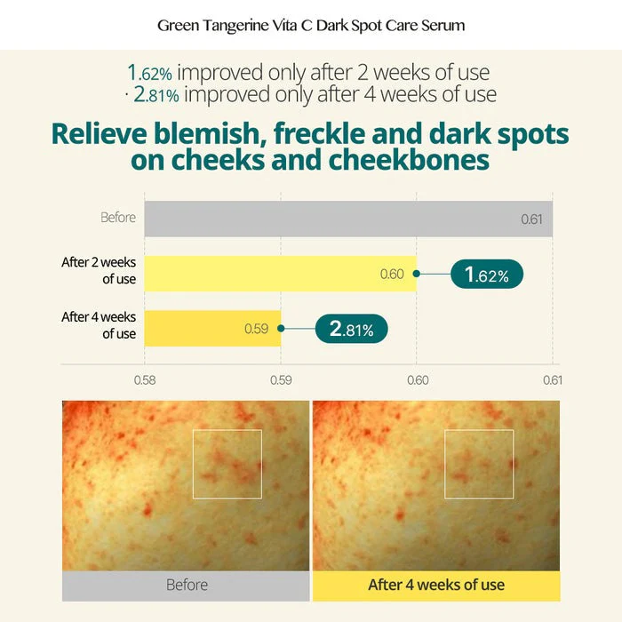 GOODAL GREEN TANGERINE VITA C DARK SPOT CARE SERUM 40ml 구달 청귤 비타씨 잡티 케어 세럼 40ml - Image 7