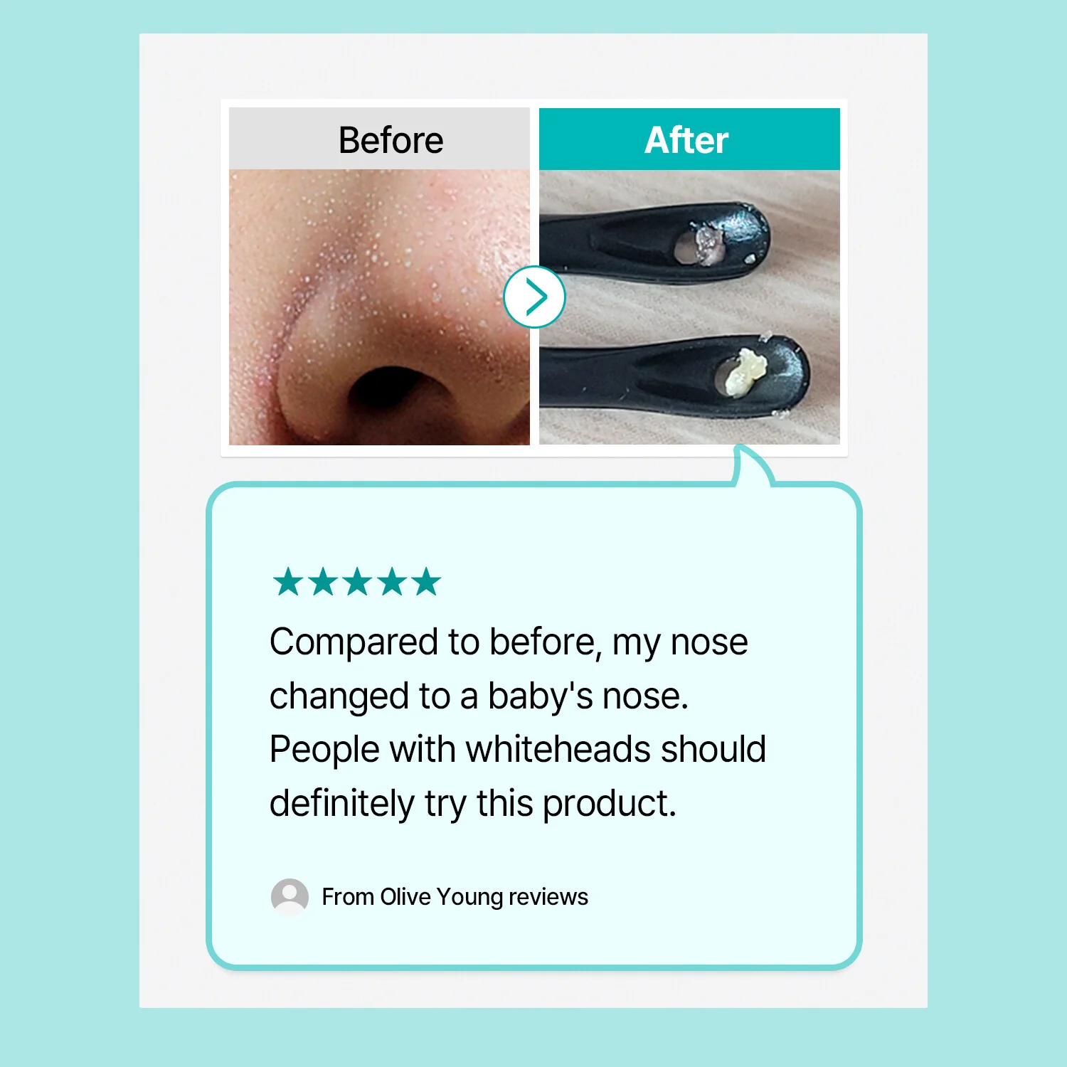 ILSO Natural Mild Clear Nose Pack 5ea 일소 네추럴 마일드 클리어 노우즈 팩 5매입 - Image 7