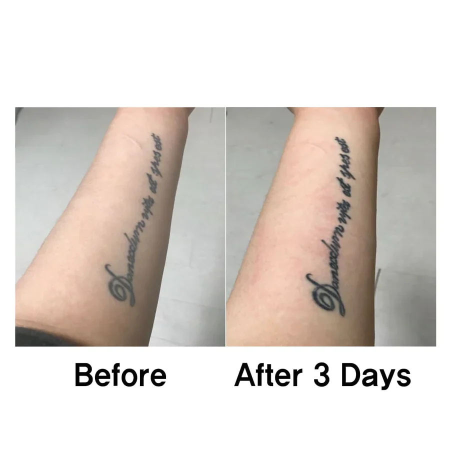 Labottach Tattoo Care Patch (for old tattoo) 4 Sheets 라보타치 타투 케어 패치 4매 - Image 4