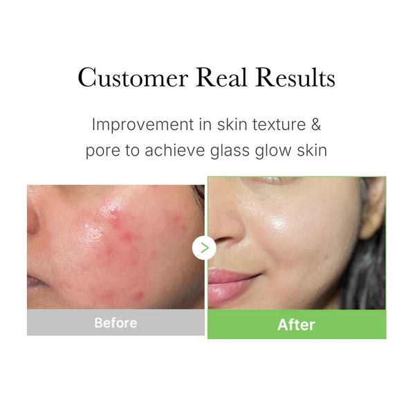 Medicube Exosome Cica Calming Toner Pad 100Pads Low-Irritating Daily Texture Care 메디큐브 엑소좀 시카 요철 진정패드 100패드 - Image 7