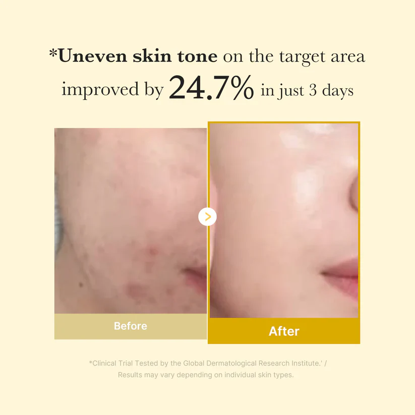 Medicube Kojic Acid Tumeric Night Wrapping Mask 75ml / 2.53 fl. oz. 메디큐브 코직애씨드 터메릭 비타 랩핑마스크 75ml / 2.53 fl. oz. - Image 7