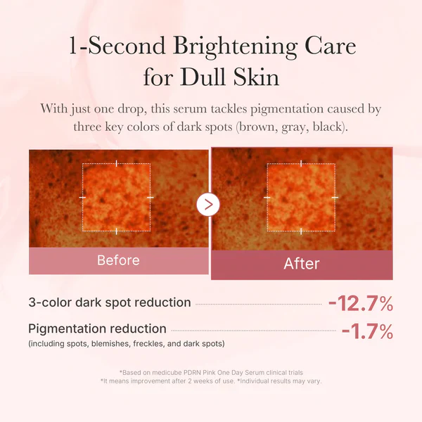 Medicube PDRN Pink One Day Serum PDRN 10EA 메디큐브 핑크 원데이 세럼 10개입 - Image 7