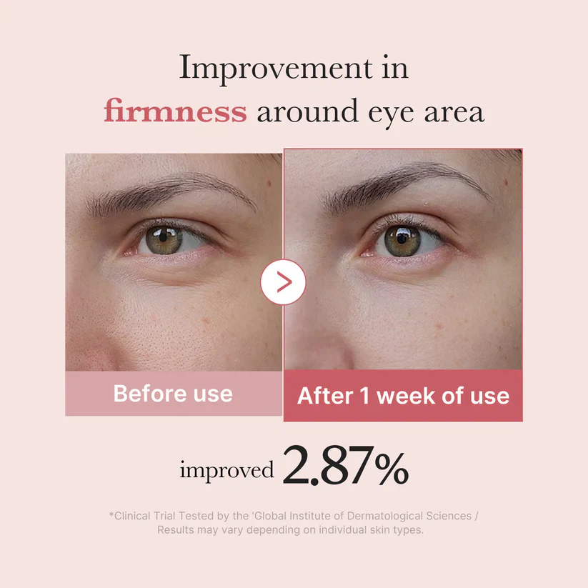 Medicube PDRN Pink Peptide Eye Cream 30ml 메디큐브 PDRN 핑크 펩타이드 아이크림 30ml - Image 7