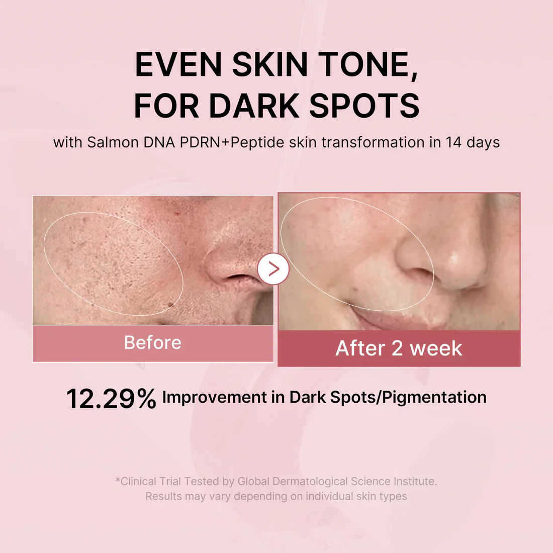 Medicube PDRN Pink Peptide Toner 250ml 메디큐브 PDRN 핑크 시카 수딩 토너 250ml - Image 4