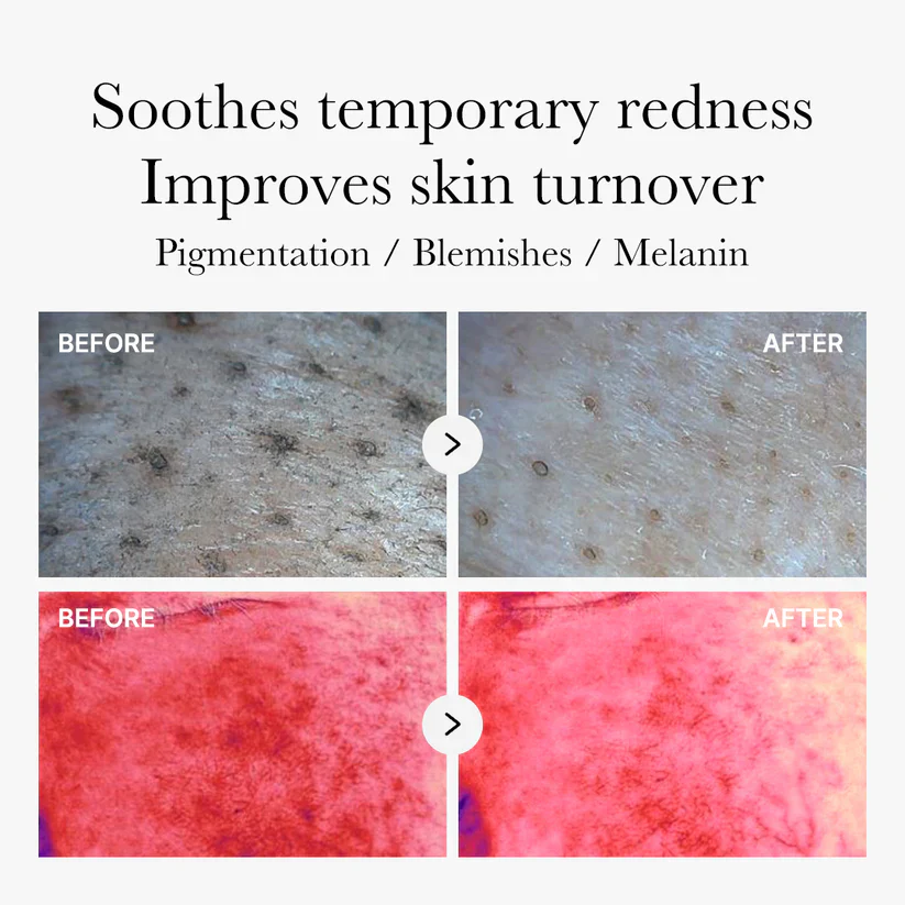 Medicube Red Succinic Acid Panthenol Pads 메디큐브 레드 석시닉 애씨드 패드 트러블개선 - Image 10