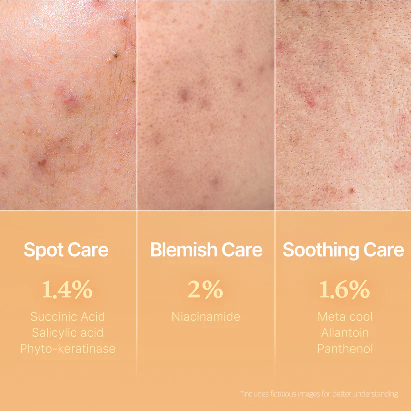 Medicube Red Succinic Acid Panthenol Pads 메디큐브 레드 석시닉 애씨드 패드 트러블개선 - Image 13
