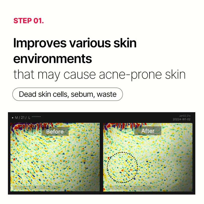 Medicube Red Succinic Acid Panthenol Pads 메디큐브 레드 석시닉 애씨드 패드 트러블개선 - Image 14