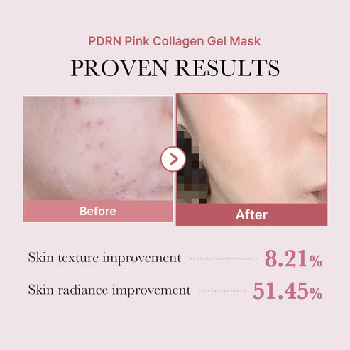 Medicube Salmon PDRN Pink Collagen Jelly Gel Mask 4EA 메디큐브 PDRN 핑크 콜라겐 겔 마스크 4매입 - Image 8