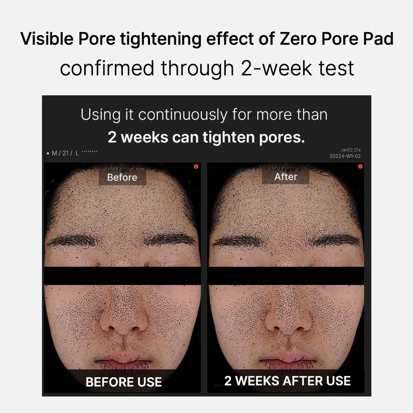 Medicube Zero Pore Pad 2.0 메디큐브 제로모공패드 2.0 - Image 4