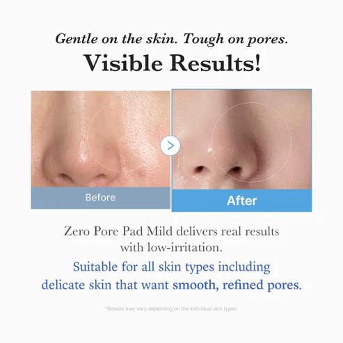 Medicube Zero Pore Pad Mild 70 Pads 메디큐브 제로 모공 패드 마일드 70매 - Image 5