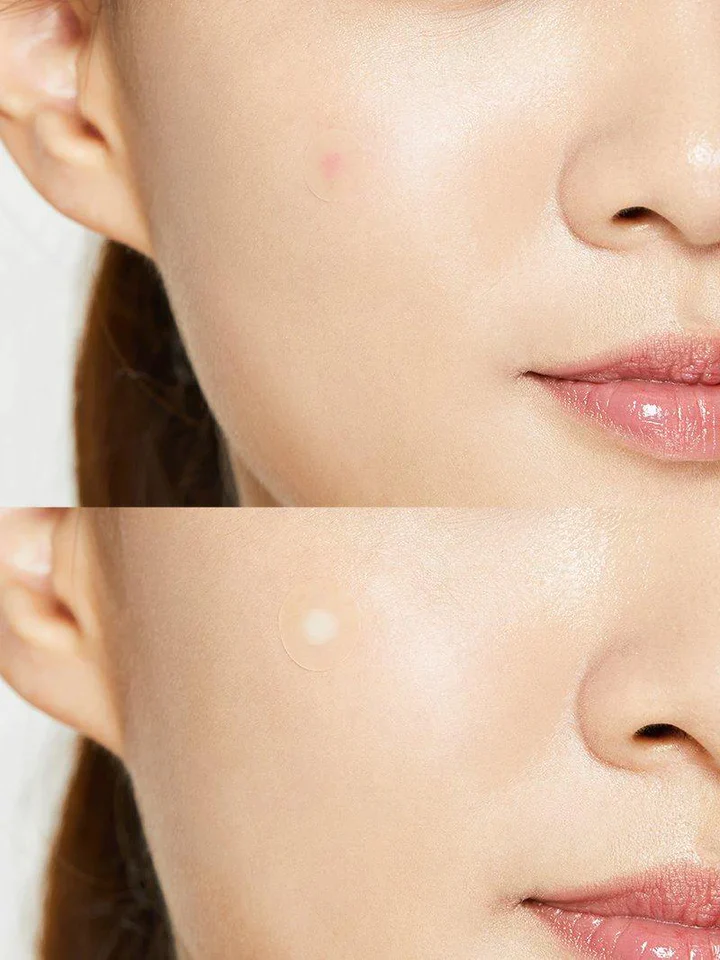 COSRX Acne Pimple Master Patch 코스알엑스 아크네 핌플 마스터 패치 - Image 11