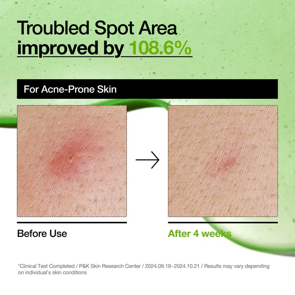 Anua Azelaic Acid 100 Hyaluron Redness Soothing Serum 1.01 fl. oz. / 30ml - Image 7