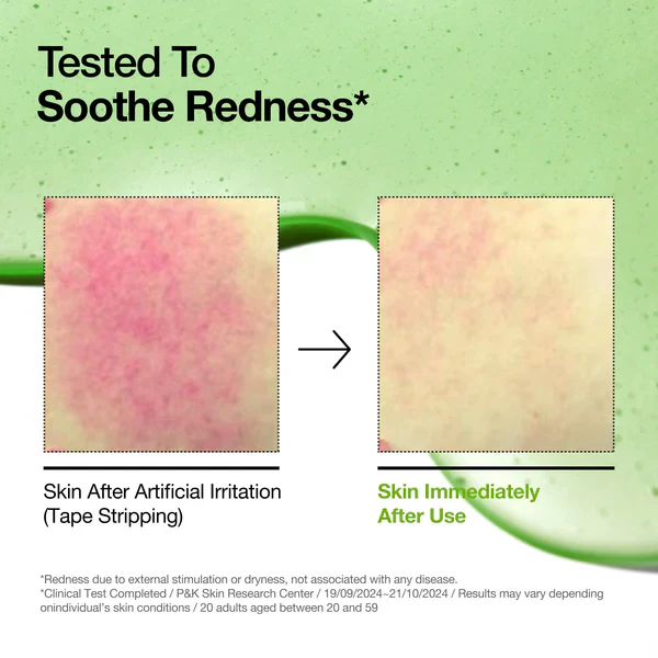 Anua Azelaic Acid 100 Hyaluron Redness Soothing Serum 1.01 fl. oz. / 30ml - Image 8
