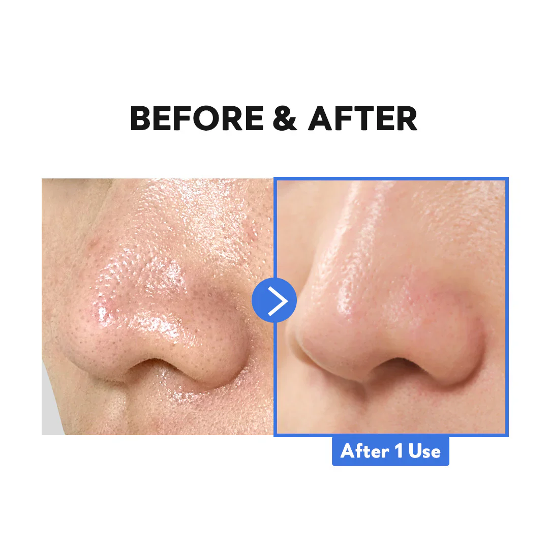 TIRTIR Hydro Boost Enzyme Cleansing Balm 120ml / 4.05 fl.oz. 티르티르 하이드로 부스트 엔자임 클렌징 밤 120ml / 4.05 fl.oz. - Image 4
